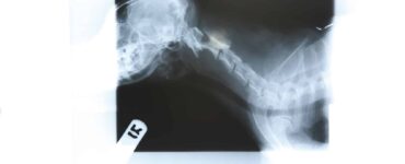 dog collapsed trachea xray